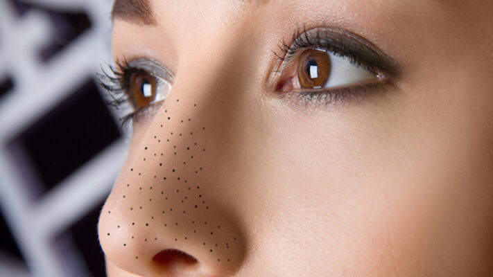 20210518 mun dau den hinh thanh do vi khuan bui ban 2