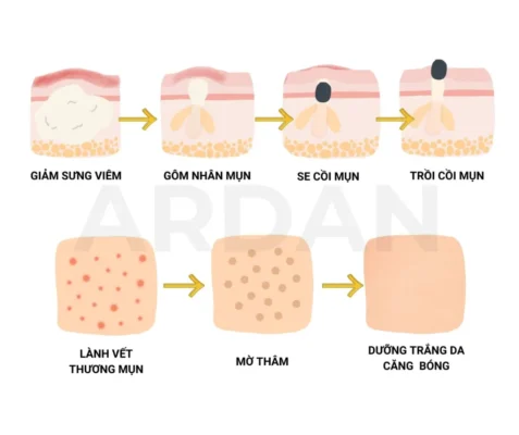Sau 7 ngày sử dụng Serum Giảm Mụn Mờ Thâm ARDAN